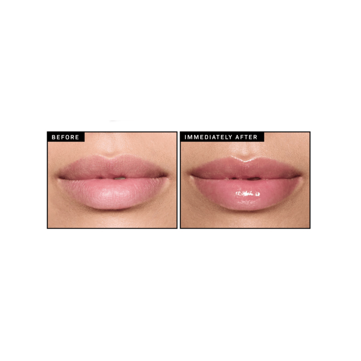 Revision lip Revision YouthFULL Lip Replenisher