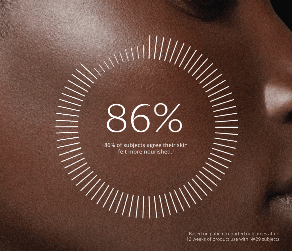 86% of Re-Q study participants agreed their skin felt more nourished after 12 weeks